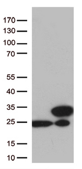 TAGLN2 / Transgelin 2 Antibody - HEK293T cells were transfected with the pCMV6-ENTRY control. (Left lane) or pCMV6-ENTRY TAGLN2. (Right lane) cDNA for 48 hrs and lysed. Equivalent amounts of cell lysates. (5 ug per lane) were separated by SDS-PAGE and immunoblotted with anti-TAGLN2. (1:500)