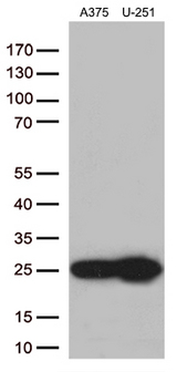 TAGLN2 / Transgelin 2 Antibody - Western blot analysis of extracts. (35ug) from 2 different cell lines by using anti-TAGLN2 monoclonal antibody. (1:500)