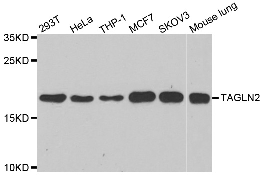 TAGLN2 / Transgelin 2 Antibody - Western blot analysis of extracts of various cell lines.