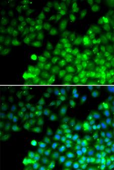 TAGLN2 / Transgelin 2 Antibody - Immunofluorescence analysis of MCF7 cells.