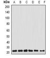 TAGLN2 / Transgelin 2 Antibody - Western blot analysis of Transgelin-2 expression in HEK293T (A); HeLa (B); THP1 (C); MCF7 (D); SKOV3 (E); mouse lung (F) whole cell lysates.