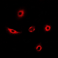 TAGLN2 / Transgelin 2 Antibody - Immunofluorescent analysis of Transgelin-2 staining in MCF7 cells. Formalin-fixed cells were permeabilized with 0.1% Triton X-100 in TBS for 5-10 minutes and blocked with 3% BSA-PBS for 30 minutes at room temperature. Cells were probed with the primary antibody in 3% BSA-PBS and incubated overnight at 4 deg C in a humidified chamber. Cells were washed with PBST and incubated with a DyLight 594-conjugated secondary antibody (red) in PBS at room temperature in the dark.