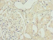 TAGLN2 / Transgelin 2 Antibody - Immunohistochemistry of paraffin-embedded human kidney tissue at dilution 1:100