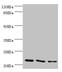 TAGLN2 / Transgelin 2 Antibody - Western blot All Lanes:TAGLN2 antibody at 4.04ug/ml Lane 1:293T whole cell lysate Lane 2:K562 whole cell lysate Lane 3:MCF-7 whole cell lysate Secondary Goat polyclonal to rabbit at 1/10000 dilution Predicted band size: 23,25 kDa Observed band size: 22 kDa