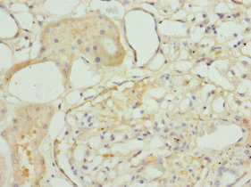 TAGLN2 / Transgelin 2 Antibody - Immunohistochemistry of paraffin-embedded human kidney tissue at dilution 1:100