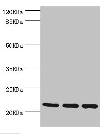 TAGLN2 / Transgelin 2 Antibody - Western blot All Lanes:TAGLN2 antibody at 2.64ug/ml Lane 1:293T whole cell lysate Lane 2:K562 whole cell lysate Lane 3:MCF-7 whole cell lysate Secondary Goat polyclonal to rabbit at 1/10000 dilution Predicted band size: 23,25 kDa Observed band size: 22 kDa