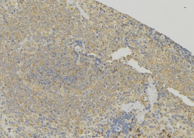 TAGLN2 / Transgelin 2 Antibody - 1:100 staining human lymph node tissue by IHC-P. The sample was formaldehyde fixed and a heat mediated antigen retrieval step in citrate buffer was performed. The sample was then blocked and incubated with the antibody for 1.5 hours at 22°C. An HRP conjugated goat anti-rabbit antibody was used as the secondary.