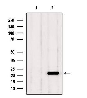 TAGLN2 / Transgelin 2 Antibody - Western blot analysis of extracts of rat brain tissue using Transgelin 2 antibody. Lane 1 was treated with the blocking peptide.