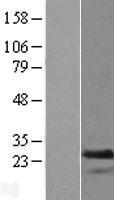 TAGLN2 / Transgelin 2 Protein - Western validation with an anti-DDK antibody * L: Control HEK293 lysate R: Over-expression lysate