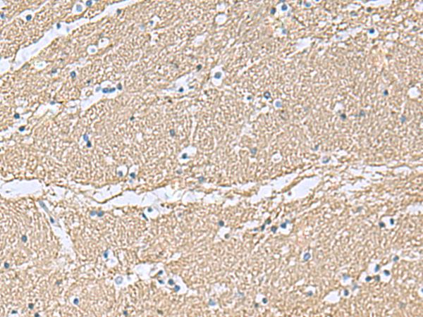 TAGLN3 / Neuronal Protein 22 Antibody - Immunohistochemistry of paraffin-embedded Human brain tissue  using TAGLN3 Polyclonal Antibody at dilution of 1:70(×200)