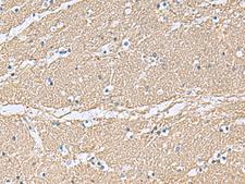 TAGLN3 / Neuronal Protein 22 Antibody - Immunohistochemistry of paraffin-embedded Human brain tissue  using TAGLN3 Polyclonal Antibody at dilution of 1:70(×200)