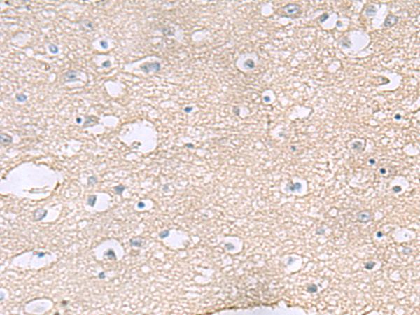 TAGLN3 / Neuronal Protein 22 Antibody - Immunohistochemistry of paraffin-embedded Human brain tissue  using TAGLN3 Polyclonal Antibody at dilution of 1:60(×200)