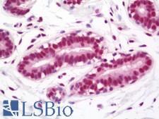 TAL1 Antibody - Human Breast: Formalin-Fixed, Paraffin-Embedded (FFPE)