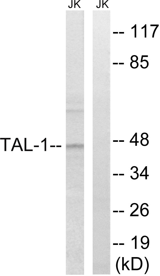 TAL1 Antibody - Western blot analysis of lysates from Jurkat cells, treated with PMA 125ng/ml 30', using TAL-1 Antibody. The lane on the right is blocked with the synthesized peptide.
