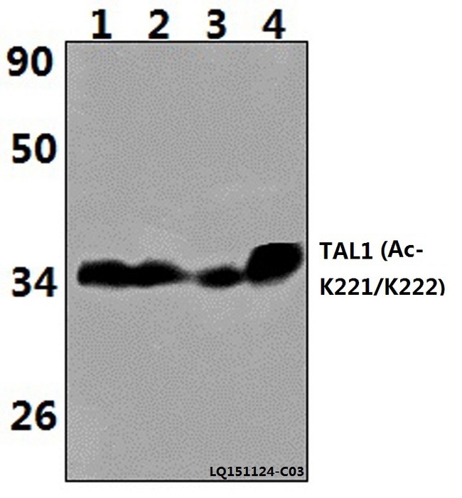 TAL1 Antibody - Western blot of TAL1 (Acetyl-K221/K222) polyclonal antibody at 1:500 dilution. Lane 1: HEK293T whole cell lysate (40 ug). Lane 2: C6 whole cell lysate (40 ug)). Lane 3: PC12 whole cell lysate (40 ug). Lane 4: MCF-7 whole cell lysate (40 ug).