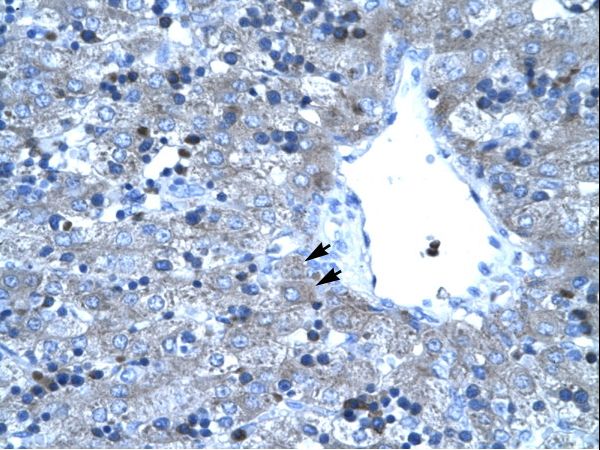TAL1 Antibody - Human Liver.  This image was taken for the unconjugated form of this product. Other forms have not been tested.