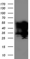 TAL1 Antibody - HEK293T cells were transfected with the pCMV6-ENTRY control (Left lane) or pCMV6-ENTRY TAL1 (Right lane) cDNA for 48 hrs and lysed. Equivalent amounts of cell lysates (5 ug per lane) were separated by SDS-PAGE and immunoblotted with anti-TAL1.