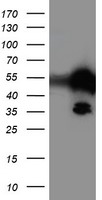 TAL1 Antibody - HEK293T cells were transfected with the pCMV6-ENTRY control (Left lane) or pCMV6-ENTRY TAL1 (Right lane) cDNA for 48 hrs and lysed. Equivalent amounts of cell lysates (5 ug per lane) were separated by SDS-PAGE and immunoblotted with anti-TAL1.