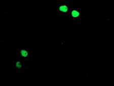 TAL1 Antibody - Anti-TAL1 mouse monoclonal antibody immunofluorescent staining of COS7 cells transiently transfected by pCMV6-ENTRY TAL1.