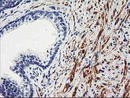 TAL1 Antibody - IHC of paraffin-embedded Human prostate tissue using anti-TAL1 mouse monoclonal antibody.