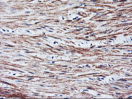 TAL1 Antibody - IHC of paraffin-embedded Human colon tissue using anti-TAL1 mouse monoclonal antibody.