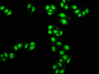 TAL1 Antibody - Immunofluorescence staining of HepG2 cells at a dilution of 1:100, counter-stained with DAPI. The cells were fixed in 4% formaldehyde, permeabilized using 0.2% Triton X-100 and blocked in 10% normal Goat Serum. The cells were then incubated with the antibody overnight at 4 °C.The secondary antibody was Alexa Fluor 488-congugated AffiniPure Goat Anti-Rabbit IgG (H+L) .