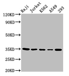 TAL1 Antibody - Positive Western Blot detected in Raji whole cell lysate, Jurkat whole cell lysate, K562 whole cell lysate, A549 whole cell lysate, 293 whole cell lysate. All lanes: TAL1 antibody at 5.5 µg/ml Secondary Goat polyclonal to rabbit IgG at 1/50000 dilution. Predicted band size: 35, 32, 17 KDa. Observed band size: 35 KDa