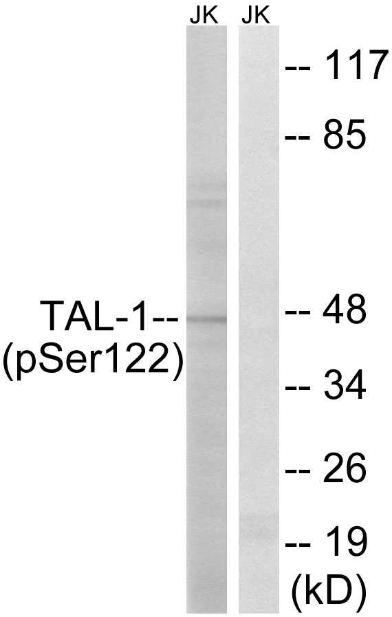 TAL1 Antibody - Western blot analysis of lysates from Jurkat cells treated with PMA 125ng/ml 30', using TAL-1 (Phospho-Ser122) Antibody. The lane on the right is blocked with the phospho peptide.
