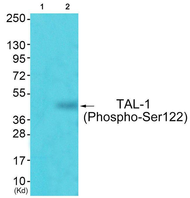 TAL1 Antibody - Western blot of extracts from JK cells (Lane 2), using TAL-1 (Phospho-Ser122) Antibody. The lane on the left is treated with synthesized peptide.