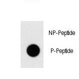 TAL1 Antibody - Dot blot of anti-Phospho-TAL1-pT90 antibody on nitrocellulose membrane. 50ng of Phospho-peptide or Non Phospho-peptide per dot were adsorbed. Antibody working concentrations are 0.5ug per ml.
