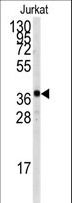 TAL1 Antibody - Western blot of anti-TAL1 Antibody (T90) in Jurkat cell line lysates (35 ug/lane). TAL1 (arrow) was detected using the purified antibody.