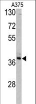 TALDO1 / Transaldolase 1 Antibody - Western blot of TALDO1 antibody in A375 cell line lysates (35 ug/lane). TALDO1 (arrow) was detected using the purified antibody.