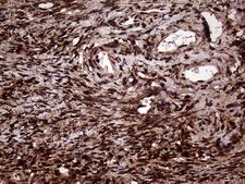 TALDO1 / Transaldolase 1 Antibody - Immunohistochemical staining of paraffin-embedded Human Ovary tissue within the normal limits using anti-TALDO1 mouse monoclonal antibody. (Heat-induced epitope retrieval by 1mM EDTA in 10mM Tris buffer. (pH8.5) at 120°C for 3 min. (1:500)
