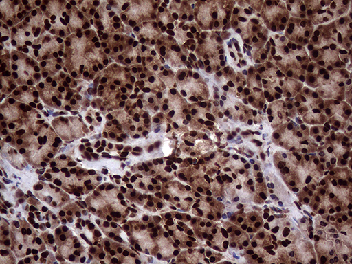 TALDO1 / Transaldolase 1 Antibody - Immunohistochemical staining of paraffin-embedded Human pancreas tissue within the normal limits using anti-TALDO1 mouse monoclonal antibody. (Heat-induced epitope retrieval by 1mM EDTA in 10mM Tris buffer. (pH8.5) at 120°C for 3 min. (1:500)