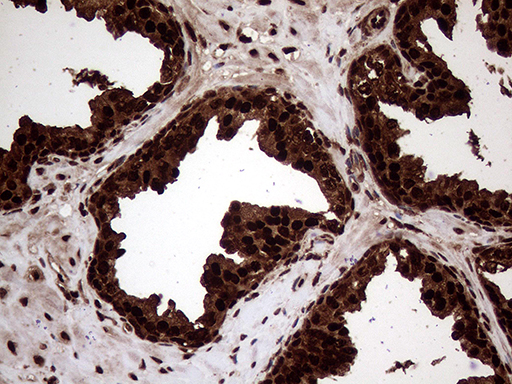 TALDO1 / Transaldolase 1 Antibody - Immunohistochemical staining of paraffin-embedded Human prostate tissue within the normal limits using anti-TALDO1 mouse monoclonal antibody. (Heat-induced epitope retrieval by 1mM EDTA in 10mM Tris buffer. (pH8.5) at 120°C for 3 min. (1:500)