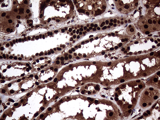 TALDO1 / Transaldolase 1 Antibody - Immunohistochemical staining of paraffin-embedded Human Kidney tissue within the normal limits using anti-TALDO1 mouse monoclonal antibody. (Heat-induced epitope retrieval by 1mM EDTA in 10mM Tris buffer. (pH8.5) at 120°C for 3 min. (1:500)