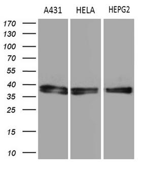 TALDO1 / Transaldolase 1 Antibody - Western blot analysis of extracts. (35ug) from 3 different cell lines by using anti-TALDO1 monoclonal antibody?(1:500)