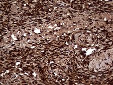TALDO1 / Transaldolase 1 Antibody - Immunohistochemical staining of paraffin-embedded Human Ovary tissue within the normal limits using anti-TALDO1 mouse monoclonal antibody. (Heat-induced epitope retrieval by 1mM EDTA in 10mM Tris buffer. (pH8.5) at 120°C for 3 min. (1:500)