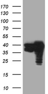 TALDO1 / Transaldolase 1 Antibody - HEK293T cells were transfected with the pCMV6-ENTRY control. (Left lane) or pCMV6-ENTRY TALDO1. (Right lane) cDNA for 48 hrs and lysed. Equivalent amounts of cell lysates. (5 ug per lane) were separated by SDS-PAGE and immunoblotted with anti-TALDO1. (1:2000)