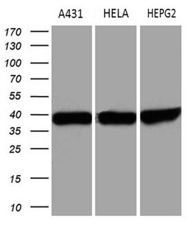 TALDO1 / Transaldolase 1 Antibody - Western blot analysis of extracts. (35ug) from 3 different cell lines by using anti-TALDO1 monoclonal antibody. (1:500)