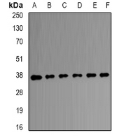 TALDO1 / Transaldolase 1 Antibody - Western blot analysis of Transaldolase expression in HEK293T (A); A431 (B); SW480 (C); mouse brain (D); mouse kidney (E); rat liver (F) whole cell lysates.