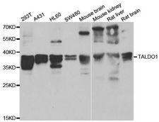 TALDO1 / Transaldolase 1 Antibody - Western blot analysis of extracts of various cell lines, using TALDO1 antibody at 1:1000 dilution. The secondary antibody used was an HRP Goat Anti-Rabbit IgG (H+L) at 1:10000 dilution. Lysates were loaded 25ug per lane and 3% nonfat dry milk in TBST was used for blocking. An ECL Kit was used for detection and the exposure time was 30s.