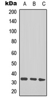 Talin 1+2 Antibody - Western blot analysis of TAL1/2 (AcK221+222/K36+37) expression in Jurkat (A); mouse heart (B); mouse brain (C) whole cell lysates.