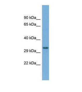TAMM41 / C3orf31 Antibody - Western blot of Human OVCAR-3. TAMM41 antibody dilution 1.0 ug/ml.  This image was taken for the unconjugated form of this product. Other forms have not been tested.