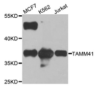 TAMM41 / C3orf31 Antibody - Western blot analysis of extracts of various cell lines.