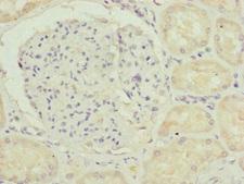 TAMM41 / C3orf31 Antibody - Immunohistochemistry of paraffin-embedded human kidney tissue at dilution of 1:100