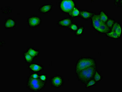 TAMM41 / C3orf31 Antibody - Immunofluorescent analysis of PC3 cells diluted at 1:100 and Alexa Fluor 488-congugated AffiniPure Goat Anti-Rabbit IgG(H+L)