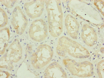 TAMM41 / C3orf31 Antibody - Immunohistochemistry of paraffin-embedded human kidney tissue at dilution of 1:100