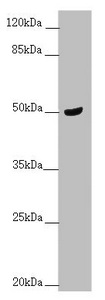 TAMM41 / C3orf31 Antibody - Western blot All Lanes:TAMM41 antibody at 1.68 ug/ml+ Mouse brain tissue Secondary Goat polyclonal to rabbit IgG at 1/10000 dilution Predicted band size: 52,36,39 kDa Observed band size: 51 kDa