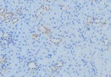 TAMM41 / C3orf31 Antibody - 1:100 staining mouse kidney tissue by IHC-P. The sample was formaldehyde fixed and a heat mediated antigen retrieval step in citrate buffer was performed. The sample was then blocked and incubated with the antibody for 1.5 hours at 22°C. An HRP conjugated goat anti-rabbit antibody was used as the secondary.